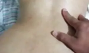 Mu anal prolapse omu ...