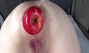 Anal fisting extreme ...